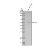 Zebrafish GATA1 Antibody WB. Western blot analysis of GATA1 expression was performed using anti-GATA1A antibody. Lane 1: zebrafish embryo tissue lysate. GATA1A is a zinc finger transcription factor that serves as a master regulator of erythropoiesis by controlling genes required for erythroid lineage commitment, hemoglobin synthesis, and red blood cell maturation. A specific immunoreactive band is detected at approximately 45 kDa, consistent with the expected molecular weight of GATA1A. The strong expression observed in zebrafish embryos reflects the critical role of GATA1A during primitive hematopoiesis and early blood development. These results demonstrate the utility of Zebrafish GATA1 Antibody for studies of hematopoiesis, erythropoiesis, developmental biology, and hematopoietic transcriptional regulation.