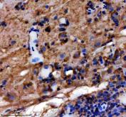 Zebrafish Vimentin Antibody / VIM Antibody Zebrafish Brain IHC. Immunohistochemical staining of paraffin-embedded zebrafish brain tissue using Zebrafish Vimentin Antibody / VIM Antibody. Vimentin expression is detected predominantly within the cytoplasm of neural support and mesenchymal-associated cells, consistent with its role as a type III intermediate filament protein involved in cytoskeletal organization, tissue development, and cellular remodeling. Heat-induced epitope retrieval was performed in EDTA buffer prior to staining. Tissue sections were blocked with 10% goat serum and incubated with the primary antibody (2 ug/ml) overnight at 4Â°C, followed by an HRP-conjugated goat anti-rabbit secondary antibody and DAB chromogen for visualization.