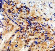 Zebrafish FZD8 Antibody / Frizzled 8A Antibody Zebrafish Brain IHC. Immunohistochemical staining of paraffin-embedded zebrafish brain tissue using Zebrafish FZD8 Antibody / Frizzled 8A Antibody. FZD8A expression is detected predominantly within the cytoplasm of neural cells, consistent with its role as a Frizzled family receptor that mediates Wnt signaling during nervous system development, tissue patterning, and cell fate determination. Heat-induced epitope retrieval was performed in EDTA buffer prior to staining. Tissue sections were blocked with 10% goat serum and incubated with the primary antibody (2 ug/ml) overnight at 4Â°C, followed by an HRP-conjugated goat anti-rabbit secondary antibody and DAB chromogen for visualization.