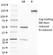SDS-PAGE Analysis of Purified, BSA-Free PSA Antibody (clone A67-B/E3). Confirmation of Integrity and Purity of the Antibody.