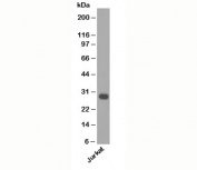 Bcl-XL Antibody WB. Western blot analysis of human Jurkat cell lysate using Bcl-XL Antibody / Anti-Apoptotic Protein Antibody, clone BX006, demonstrates a distinct immunoreactive band at approximately 26-30 kDa, consistent with expression of Bcl-XL, the major anti-apoptotic isoform encoded by the BCL2L1 gene. Bcl-XL functions as a key regulator of mitochondrial apoptosis by inhibiting pro-apoptotic BCL2 family proteins and promoting cellular survival under conditions of physiological and cellular stress. The detected band is consistent with the expected molecular weight of Bcl-XL and supports specific recognition of endogenous BCL2L1 protein in Jurkat cells. Predicted molecular weight: 26-30 kDa.