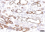 IHC testing of FFPE human kidney transplant tissue (20X) stained with C4d antibody (C4D204).