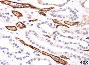 IHC testing of FFPE human kidney transplant tissue (40X) stained with Complement 4d / C4d antibody (C4D204).