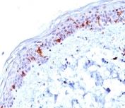 CD1A Antibody Clone O10. Immunohistochemistry analysis of CD1A / CD1a expression in human skin tissue using CD1A Antibody Clone O10. Strong membranous and cytoplasmic staining is observed in dendritic cells within the epidermis, consistent with Langerhans cell localization, while surrounding keratinocytes remain largely negative. The staining pattern highlights tissue-resident antigen-presenting cells within the epithelial layer and reflects the established use of clone O10 for detecting CD1a-positive dendritic cells in skin.