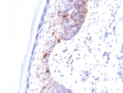 CD1A Antibody for IHC. Immunohistochemistry analysis of CD1A / CD1a expression in FFPE human skin tissue using CD1A Antibody. Membranous and cytoplasmic staining is observed in scattered dendritic cells within the epidermis, consistent with Langerhans cell localization, while surrounding keratinocytes remain largely negative. The distribution of CD1a-positive cells along the epithelial layer supports identification of antigen-presenting dendritic cells involved in local immune surveillance within skin.