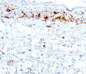 CD1A Antibody for IHC. Immunohistochemistry analysis of CD1A / CD1a expression in human skin tissue using CD1A Antibody. Membranous and cytoplasmic staining is observed in dendritic cells within the epidermis, consistent with Langerhans cell localization, while surrounding keratinocytes remain largely negative. The distribution of CD1a-positive cells highlights antigen-presenting dendritic cells positioned at the epithelial interface, supporting evaluation of immune activation and antigen presentation within skin.