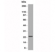 CD3e Antibody for WB Jurkat. Western blot testing of CD3 Epsilon / CD3E antibody in human Jurkat cell lysate using CD3e Antibody for WB / CD3 Epsilon Western Blot Antibody. Lane 1: human Jurkat cell lysate. A band is detected at approximately 20-25 kDa, consistent with the predicted molecular weight of CD3 epsilon. The clear, well-defined band with minimal background supports specific detection of CD3 epsilon and reliable performance in western blot analysis of T-cell-derived lysates.