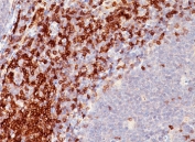 CD5 Antibody for IHC. Immunohistochemistry analysis of CD5 antibody staining in human tonsil tissue using an immune cell communication marker antibody, clone C5/473. Strong membranous staining is observed in interfollicular T lymphocytes with dense labeling of T cell zones adjacent to germinal centers, while follicular B cell regions remain largely negative. The staining pattern highlights lymphoid architecture and reflects the role of CD5 in mediating immune cell interactions and signaling at sites of lymphocyte communication.