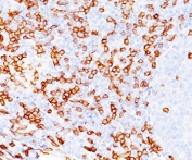 CD8A Antibody IHC. Immunohistochemistry testing of FFPE human tonsil tissue stained with CD8a antibody (clone C8/468). Note cell surface staining.