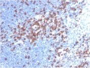 CD8A Antibody Lymph Node IHC. Immunohistochemistry staining of FFPE human lymph node tissue with CD8a antibody (clone C8/468). HIER: boil tissue sections in pH 9 10mM Tris with 1mM EDTA for 20 min and allow to cool before testing.