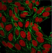 HCAM Antibody HeLa Cell IF. Immunofluorescence analysis of HCAM / CD44 expression in human HeLa cells using mouse monoclonal antibody clone 156-3C11 (green) with Reddot nuclear stain (red). Membrane-associated fluorescence is observed outlining cell borders, with additional punctate signal consistent with cell surface and peripheral distribution of HCAM/CD44. The staining pattern highlights heterogeneous expression across cells and supports its use for visualizing cell surface localization and HCAM/CD44-mediated cellular interactions in cultured human cells.