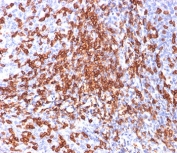 HCAM Antibody Tonsil IHC. Immunohistochemistry analysis of HCAM / CD44 expression in FFPE human tonsil tissue using mouse monoclonal antibody clone 156-3C11. Membranous HRP-DAB brown staining is observed in lymphoid cells within the tonsillar tissue, highlighting widespread cell surface expression consistent with HCAM/CD44 localization on immune cell populations. The staining pattern demonstrates dense distribution of positive cells within lymphoid regions and supports its use for evaluating HCAM/CD44 expression and cellular organization in lymphoid tissue. Heat induced epitope retrieval was performed by boiling tissue sections in pH 9 10mM Tris with 1mM EDTA for 20 min followed by cooling at RT before testing.