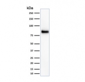 HCAM Antibody Human HeLa Cell Line WB. Western blot analysis of HCAM / CD44 expression in human HeLa cell lysate using mouse monoclonal antibody clone 156-3C11. A band is detected at approximately 80 kDa, consistent with the predicted molecular weight of HCAM/CD44 (HCAM / CD44 antigen). CD44 is a glycosylated transmembrane protein, and the observed band reflects the core protein with potential variation in apparent molecular weight due to glycosylation of the extracellular domain. The detected signal supports HCAM/CD44 expression in HeLa cells and is consistent with its role as a cell surface adhesion molecule.