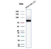 HCAM Antibody Human MDA-MB-231 Cell Line WB. Western blot analysis of HCAM / CD44 expression in human MDA-MB-231 cell lysate using mouse monoclonal antibody clone 156-3C11. A band is detected at approximately 80 kDa, consistent with the predicted molecular weight of HCAM/CD44 (HCAM / CD44 antigen). CD44 is a glycosylated transmembrane protein, and the observed band reflects the core protein with potential variation in apparent molecular weight due to glycosylation of the extracellular domain. The detected signal supports HCAM/CD44 expression in MDA-MB-231 cells, a breast cancer cell line known to express cell surface CD44.