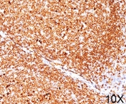 IHC testing of FFPE human tonsil stained with CD79a antibody (clone JCB117). Required HIER: boil tissue sections in pH 9 10mM Tris with 1mM EDTA for 10-20 min followed by cooling at RT for 20 minutes.