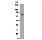 CEA Antibody Stomach Tissue WB. Western blot testing of human stomach lysate using CEA antibody (clone COL-1).