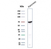 Chromogranin A Antibody Pancreas WB. Western blot testing of human pancreas tissue lysate with Chromogranin A antibody. Predicted molecular weight ~50 kDa but may be observed at higher molecular weights due to glycosylation.