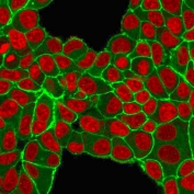 HER2 Antibody MCF-7 IF. Immunofluorescence analysis of PFA-fixed human MCF-7 cells using HER2 Antibody (green) demonstrates prominent membranous staining outlining cell borders, consistent with ErbB2 / HER2 localization as a cell surface receptor, while nuclei are counterstained with Reddot (red), supporting membrane-associated detection in cell-based assays.