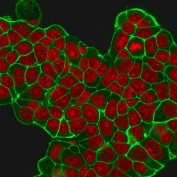 HER2 Antibody MCF-7 Membrane IF. Immunofluorescence analysis of MeOH-fixed human MCF-7 cells using HER2 Antibody (green) highlights sharp, continuous membrane-associated staining with reduced cytoplasmic background, emphasizing ErbB2 / HER2 localization at cell-cell junctions, while nuclei are counterstained with Reddot (red), supporting detection of surface receptor architecture under methanol fixation conditions.