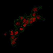 ErbB2 Antibody CF488 Conjugate IF. Immunofluorescent staining of methanol-fixed human SLBR3 cells with ErbB2 antibody (clone HRB2/258, green) and Reddot nuclear stain (red).