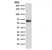 ER Antibody Clone ER506 WB. Western blot testing of MCF-7 cell lysate with ER antibody (clone ER506). Predicted molecular weight of ER alpha: ~67 kDa.