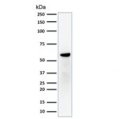 Estrogen Receptor beta Antibody Breast Cancer Cell Line WB. Western blot testing of human MCF7 cell lysate with Estrogen Receptor beta antibody (clone ERb455). Expected molecular weight: 53-59 kDa.