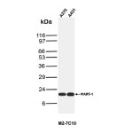 MART-1 Antibody M2-7C10 Detection in A375 and A431 Human Cancer Cells by WB. Western blot testing of human A375 melanoma (lane 1) and A431 epidermoid carcinoma (lane 2) cell lysates with MART-1 Antibody (clone M2-7C10) shows strong, discrete bands migrating at approximately 18-20 kDa. The bands are similar in intensity and migrate at the expected molecular weight region for MART-1/Melan-A, with minimal additional reactivity visible in either lane. This clean detection in two human cell lysates further demonstrates recognition of the MLANA gene product using this Melan-A Monoclonal Antibody.