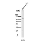 IgM Heavy Chain Antibody IM373 in Human Serum WB. Western blot testing of human serum with IgM Heavy Chain Antibody clone IM373 detects a discrete band at approximately 75 kDa, consistent with the immunoglobulin mu heavy chain. Minimal additional reactivity is visible under the tested conditions, producing a clean Western blot signal. This mouse monoclonal recognizes the heavy chain component of human IgM.