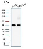 Western blot analysis of human A431 and HCT-116 cell lysates using Cytokeratin 8 Antibody TS1.