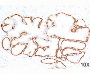 Cytokeratin 14 antibody LL002 immunohistochemistry prostate 10X