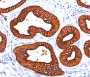 IHC staining of FFPE human skin tissue stained with Cytokeratin 18 antibody (clone DC10).