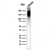 Western blot testing of human brain lysate with Neurofilament antibody (clone NF421).