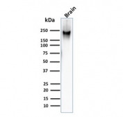 Western blot testing of human brain lysate with Neurofilament Heavy antibody (clone RT97).
