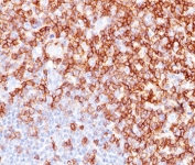 CD45RO antibody UCHL-1 immunohistochemistry tonsil