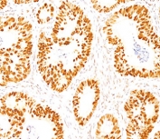 p53 Antibody Clone DO-7 / TP53 Tumor Suppressor Antibody. Immunohistochemistry analysis of FFPE normal human colon tissue demonstrates nuclear staining of epithelial cells using p53 Antibody Clone DO-7. The HRP-DAB brown chromogenic signal highlights nuclear localization of Tumor protein p53 within glandular epithelial cells of the colonic mucosa, while surrounding stromal cells show comparatively weaker staining. The staining pattern is consistent with nuclear localization of TP53 in epithelial cells of normal colon tissue.