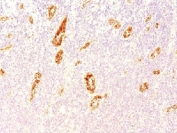 IHC testing of FFPE human pancreas tissue with vWF antibody (clone 3E2D10). Staining of formalin-fixed tissues requires boiling tissue sections in pH 9 10mM Tris with 1mM EDTA for 10-20 min followed by cooling at RT for 20 minutes.