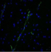 vWF Antibody for IF / von Willebrand Factor Immunofluorescence Antibody immunofluorescence analysis. Immunofluorescent staining of human brain tissue using vWF Antibody for IF (clone 3E2D10) shows strong endothelial-specific signal (green) highlighting vascular structures, with nuclei counterstained using DAPI (blue). The staining pattern reveals linear and tubular vessel-associated fluorescence consistent with endothelial cell localization of von Willebrand factor (VWF), enabling clear visualization of microvascular architecture within brain tissue.