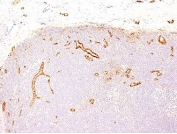 von Willebrand Factor Antibody Clone VWF635 immunohistochemistry analysis. IHC staining of FFPE human tonsil using von Willebrand Factor Antibody Clone VWF635 demonstrates endothelial-specific HRP-DAB brown staining highlighting vascular structures within lymphoid tissue. The signal is localized to vessel-associated endothelial cells, with minimal background in surrounding lymphocytes, consistent with the known distribution of von Willebrand factor (VWF) in vascular endothelium.