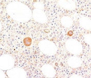 von Willebrand Factor Antibody Clone VWF635 immunohistochemistry analysis. IHC staining of FFPE human bone marrow using von Willebrand Factor Antibody Clone VWF635 shows HRP-DAB brown staining in vascular endothelial cells and scattered megakaryocytes within the marrow environment. The staining pattern highlights vessel-associated endothelium and large, morphologically distinct megakaryocytic cells, consistent with the known expression of von Willebrand factor (VWF) in both endothelial and platelet-producing lineages, with minimal background staining in surrounding hematopoietic cells.