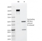SDS-PAGE analysis of purified, BSA-free FGF-23/Fibroblast Growth Factor 23 antibody (clone FGF23/638) as confirmation of integrity and purity.