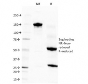Eosinophil Peroxidase Antibody Clone EPO14 SDS-PAGE Analysis. SDS-PAGE characterization of purified, BSA-free Eosinophil peroxidase / EPX antibody (clone EPO14) under non-reducing (NR) and reducing (R) conditions. A predominant band is observed at approximately 150 kDa under non-reducing conditions, consistent with intact IgG, while reducing conditions reveal bands at approximately 50 kDa and 25 kDa corresponding to heavy and light chains, respectively. The clean banding pattern confirms antibody integrity and purity with minimal degradation or contaminating proteins.