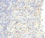 IHC testing of human tonsil with FOXP3 antibody.