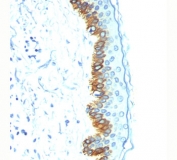 Acidic Cytokeratin antibody AE1 immunohistochemistry skin