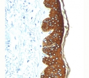Basic Cytokeratin antibody AE3 immunohistochemistry skin