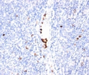 Myeloid Differentiation Marker Antibody Tonsil IHC. Immunohistochemistry analysis of human tonsil tissue stained with Myeloid Differentiation Marker Antibody clone BM-2 demonstrates distinct cytoplasmic HRP-DAB brown staining within scattered myeloid lineage-associated immune cell populations distributed throughout lymphoid tissue compartments. This BM-2 antibody highlights granulocytic differentiation-associated cellular expression patterns consistent with innate immune signaling and inflammatory tissue organization.