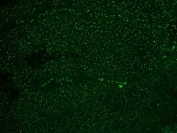 Immunofluorescent staining of FFPE colon carcinoma with Alexa Fluor 488 conjugated Nucleoli Marker antibody. HIER: boil tissue sections in pH6, 10mM citrate buffer, for 10-20 min and allow to cool before testing.