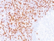CD8A Antibody Tonsil IHC. Immunohistochemistry analysis of CD8 alpha (CD8A) in FFPE human tonsil tissue shows strong membranous staining of cytotoxic T lymphocytes distributed within lymphoid regions, consistent with expected localization of CD8-positive T cells in secondary lymphoid tissue and supporting identification of immune cell populations in immune-rich tissue. The highly published clone C8/144B supports reliable and reproducible detection across established immunohistochemistry workflows (clone C8/144B).