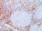 IHC testing of FFPE tonsil tissue with highly published CD8 antibody clone C8/144B.