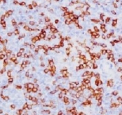 CD8A Antibody Human Tonsil IHC. Immunohistochemistry analysis of CD8 alpha (CD8A) in FFPE human tonsil tissue shows membranous staining of cytotoxic T lymphocytes within lymphoid regions, consistent with CD8-positive cells mediating antigen-specific immune responses and supporting detection of this adaptive immunity marker in secondary lymphoid tissue (clone SPM548).