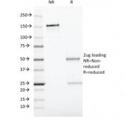 SDS-PAGE analysis of purified, BSA-free CD19 antibody (clone CVID3/429) as confirmation of integrity and purity.